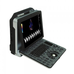 MY-A032A portable cardiac color doppler medical ultrasound scanner machine
