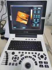 MY-A024N 12 - дюймовый ноутбук цвета доплера ультразвуковой сканер машины