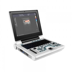 MY-A024N 12 - дюймовый ноутбук цвета доплера ультразвуковой сканер машины