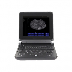 Профессиональный медицинский ультразвуковой сканер MY-A007C ноутбука BW